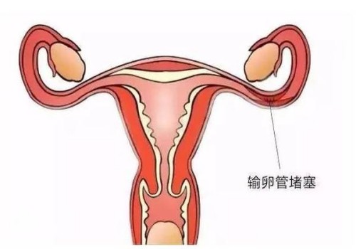 自我视觉检查，让你及时发现视力问题